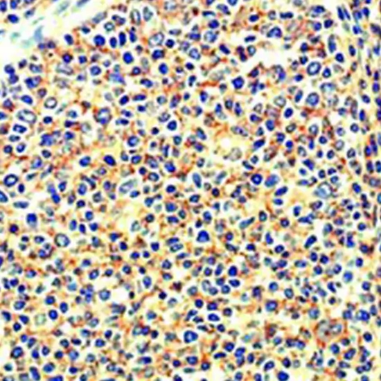 ihc - cluster of differentiation 20 (cd20)